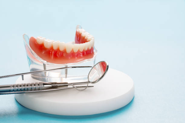 Dental Inlays and Onlays in Hoosick Falls, NY